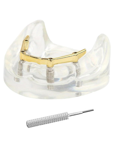 Modelo Dental Sobredentadura Kouyot Transparente 10.49x9.60cm