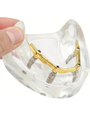 Modelo Dental Sobredentadura Kouyot Transparente 10.49x9.60cm
