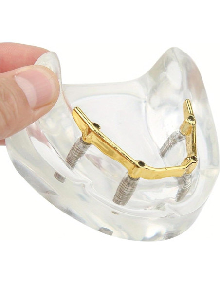 Modelo Dental Sobredentadura Kouyot Transparente 10.49x9.60cm