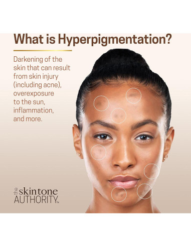 Suero para Ojos Ambi Even & Clear 14g - Anti-envejecimiento