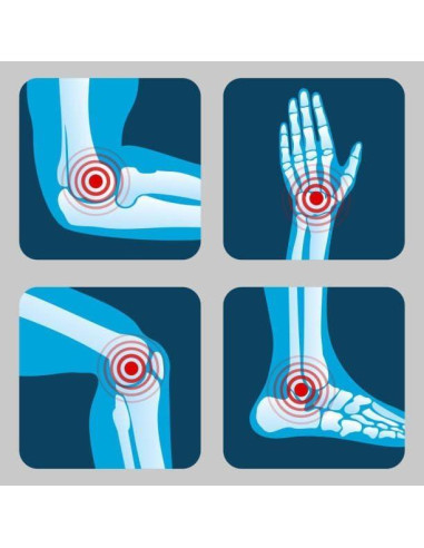 Gel Alivio Muscular y Articular Natural 170g - Natural Escapes