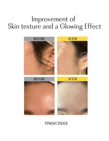 Aceite de Jojoba Orgánico PINKWONDER 10ml - Hidratante Facial