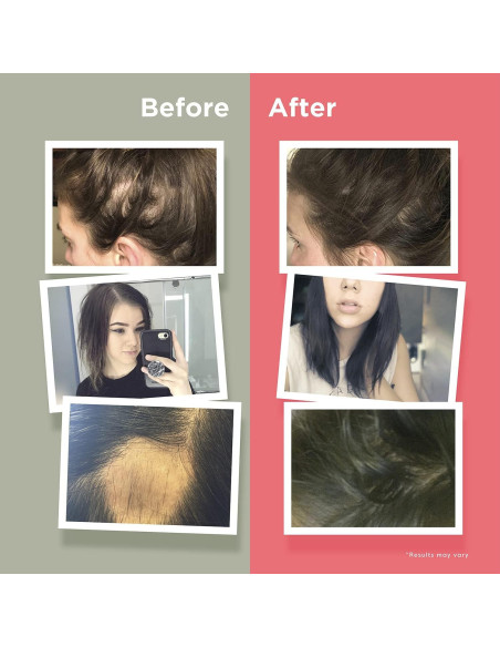 Vitaminas Naturenetics HairAnew para Crecimiento Cabello 81g