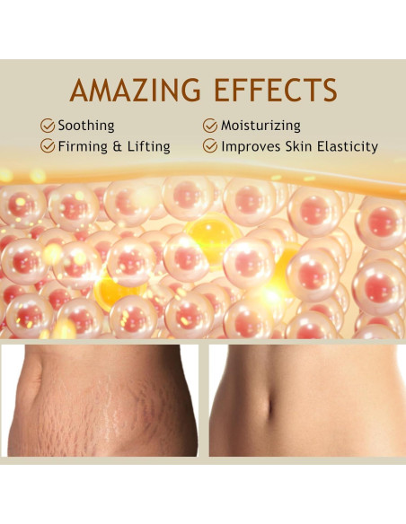 Crema Reafirmante B Flat Belly - Hidratante para Abdomen y Muslos