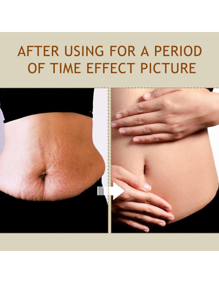 Crema Reafirmante B Flat Belly - Hidratante para Abdomen y Muslos