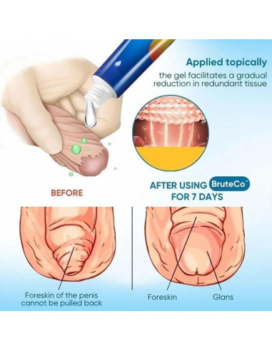 Gel Corrector de Prepucio Redundante Redundant 20G Cuidado Piel