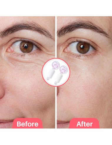 Esferas de Hielo Facial Ylowcoo 2PCS Rosa - Masaje Piel Radiante