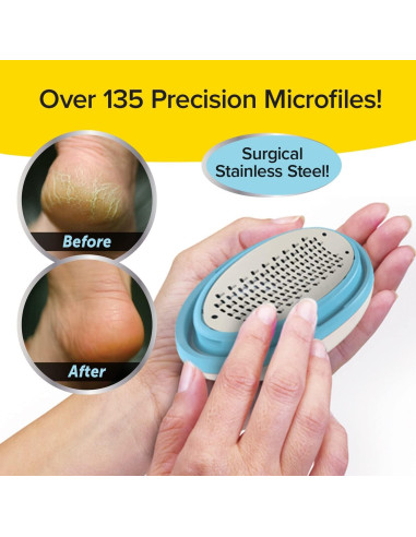 PedEgg Clásico Removedor de Callos con 135 Micro-Cuchillas