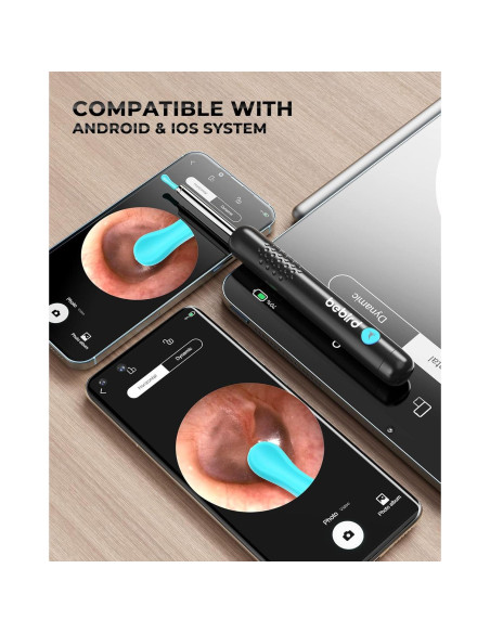 Limpiador de Oídos Bebird R1 con Cámara 1080P HD Inalámbrico