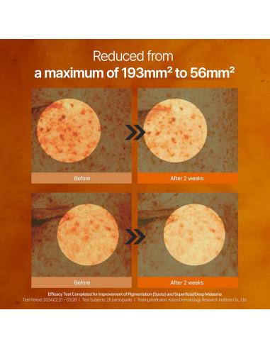 Suero Tonificante para Manchas de Café y Crema Conceal Banana