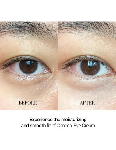 Suero Tonificante para Manchas de Café y Crema Conceal Banana