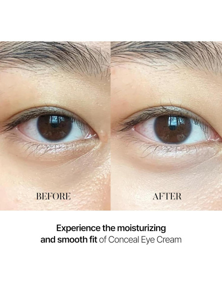 Suero Tonificante para Manchas de Café y Crema Conceal Banana