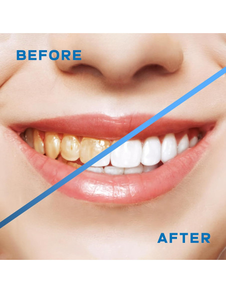 Irrigador Oral Inalámbrico Lianox LX-WF01 300ML 5 Modos IPX7