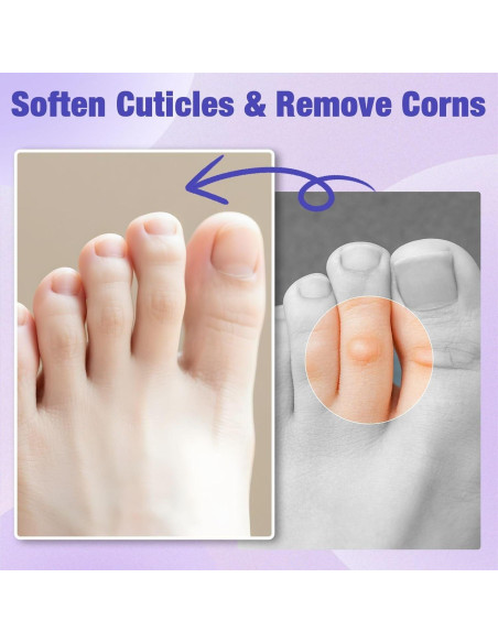 Parche Removedor de Callos QIYANA 30 Piezas 40% Ácido Salicílico