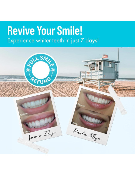 Recargas Gel Blanqueador Dental Cali White 3 x 5 ml 35% Peróxido