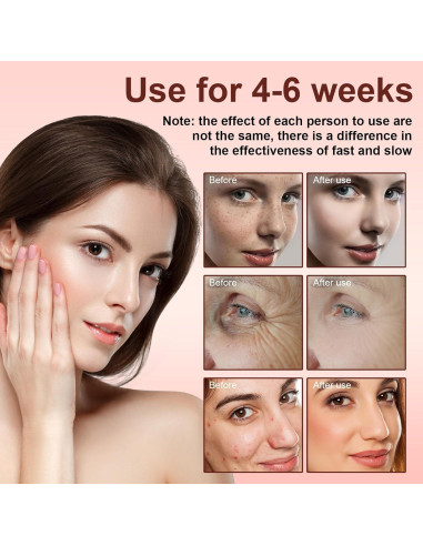 Máscara LED Terapia Luz Roja MLriyl 7 Modos Facial