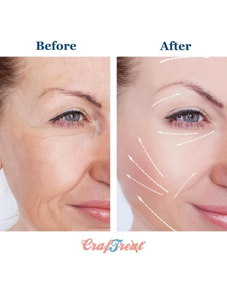 Rodillo de Hielo CrafTreat para Cara y Ojos - Silicona Verde