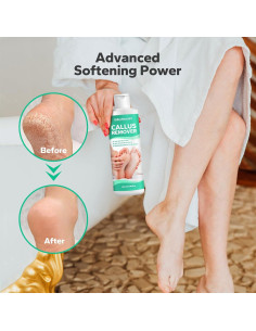 Gel Removedor de Callos SilkySecret 250 ml - Suaviza y Hidrata 2