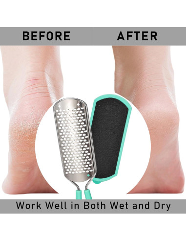 Removedor de Callos Beomeen 3 en 1 con Raspador de Acero Inoxidable