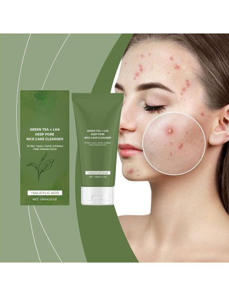 Limpiador Facial de Té Verde Flobow 117g - Piel Grasa y Acné