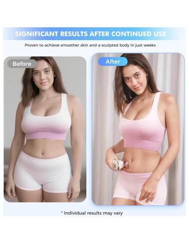 REDLOOK Escultor Corporal 3-en-1 - Masajeador Anticelulitis