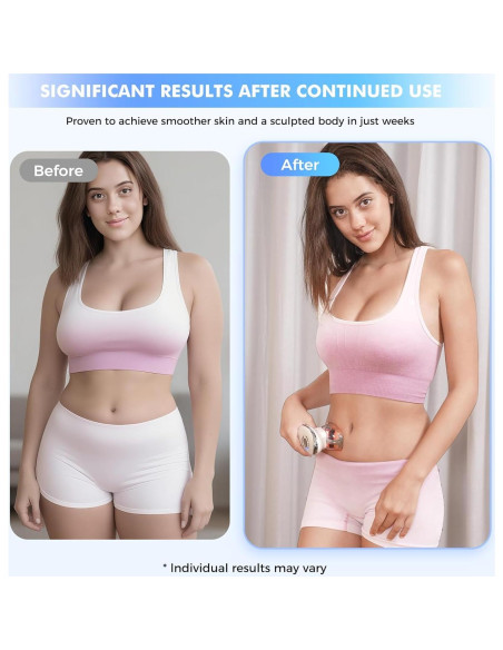 REDLOOK Escultor Corporal 3-en-1 - Masajeador Anticelulitis