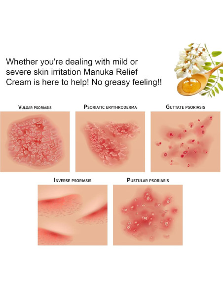 Crema Hidratante de Miel de Manuka Orgánica DRUOUO 59ml