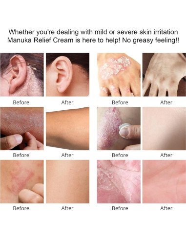 Crema Hidratante de Miel de Manuka Orgánica DRUOUO 59ml