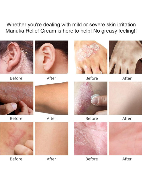 Crema Hidratante de Miel de Manuka Orgánica DRUOUO 59ml