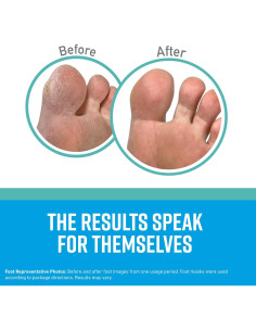 Mascarilla Hidratante para Pies O'Keeffe's - 4 Calcetines 2