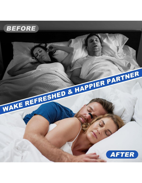 Tiras Nasales Ventro Vykor para Ronquidos - 60 Unidades, Negro