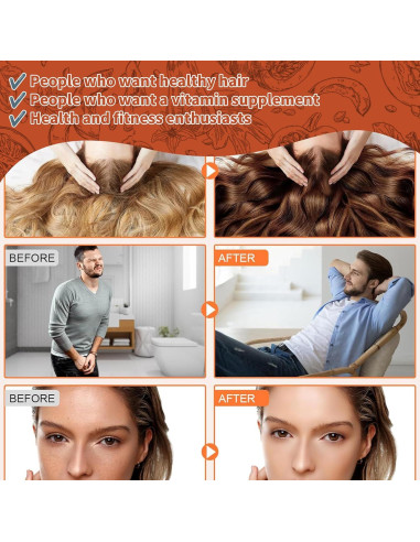 Cápsulas de Aceite de Semilla de Calabaza Ovela 200 Softgel