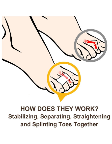 Welnove 6 Piezas Corrector de Dedo en Martillo y Vendajes