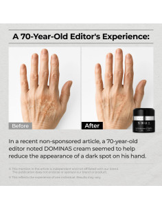 Crema Correctora de Manchas Oscuras DOMINAS 50g - Niacinamida 2