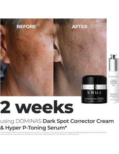 Crema Correctora de Manchas Oscuras DOMINAS 50g - Niacinamida