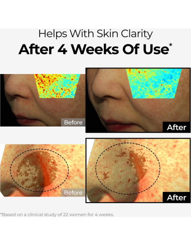 Crema Correctora de Manchas Oscuras DOMINAS 50g - Niacinamida