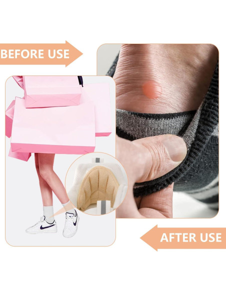 Protectores de Talón Reutilizables FootJKYX - 4 Grises