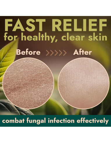 Jabón Corporal Antifúngico Terramed 500 ml - Antibacteriano