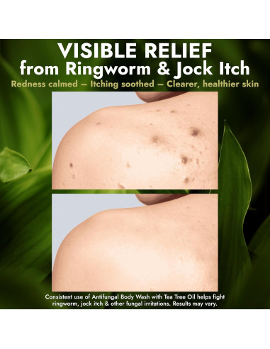 Jabón Corporal Antifúngico Terramed 500 ml - Antibacteriano