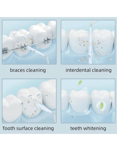 Manguera y Mango de Repuesto Waterpik WP-100 WP-300 WP-660