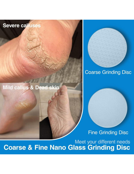 Disco de Lija de Vidrio Nano OZLICE para Removedor de Callos