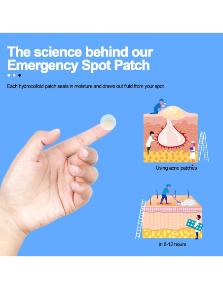 Parche Invisible para Acné Aquuaera - 180 Unidades Hidrocoloide Parche Invisible para Acné Aquuaera - 180 Unidades Hidrocoloide