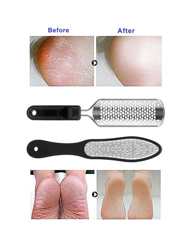 Raspador de pies Oneleaf 2PCS acero inoxidable para pedicura
