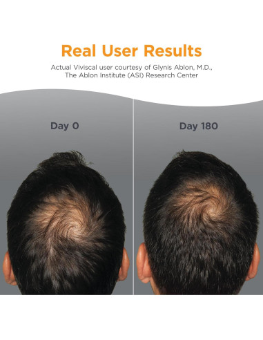 Suplemento Crecimiento Cabello Viviscal Hombre 180 Tabletas
