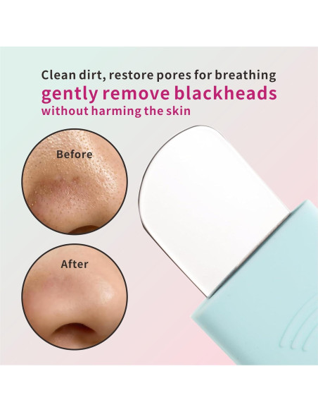 Juego de Herramientas de Belleza REVEX para Puntos Negros 2 Pzas