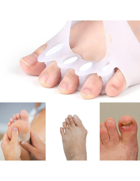 Separadores de Dedos de Gel PGYUD - Corrector de Juanetes 2 Pcs