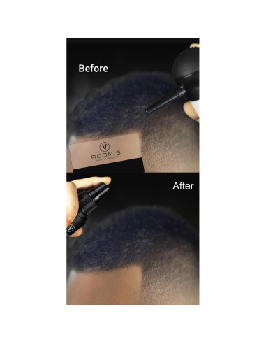 KIT 5-en-1 ADONIS Fibras de Cabello Queratina Negro