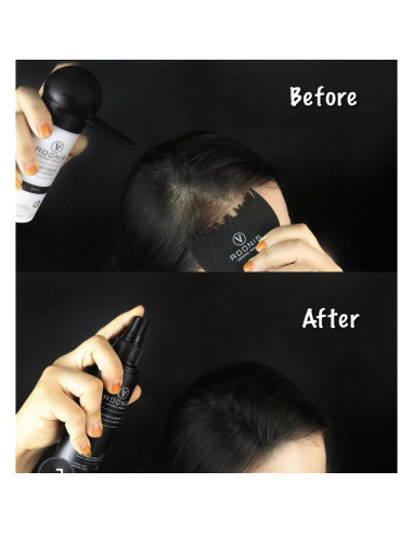 KIT 5-en-1 ADONIS Fibras de Cabello Queratina Negro