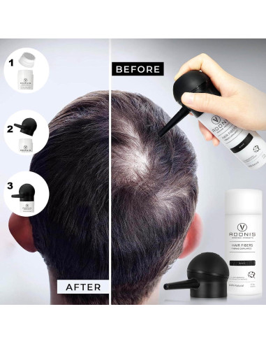 KIT 5-en-1 ADONIS Fibras de Cabello Queratina Negro