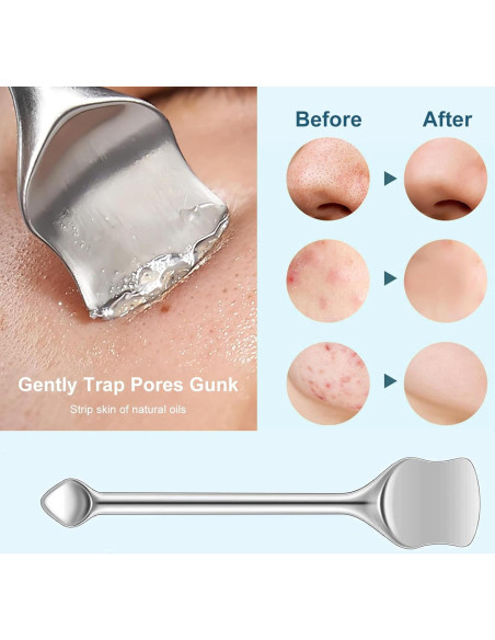 Kit de Herramientas para Remover Puntos Negros Pumwoy 9 PCS